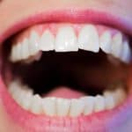 Descodificación dental: Cómo tus emociones impactan en la salud de tus dientes, InfoMistico.com