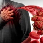 Thrombosis &#038; Biodecoding: Deciphering Emotional Blockages, InfoMistico.com