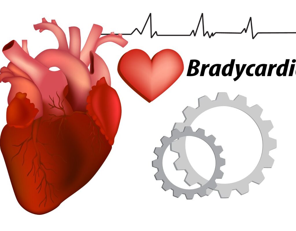 La Bradicardia Biodescodificación, InfoMistico.com